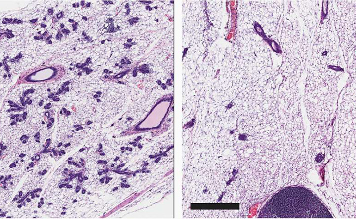 Reversione tumorale: come trasformare le cellule cancerogene in cellule sane