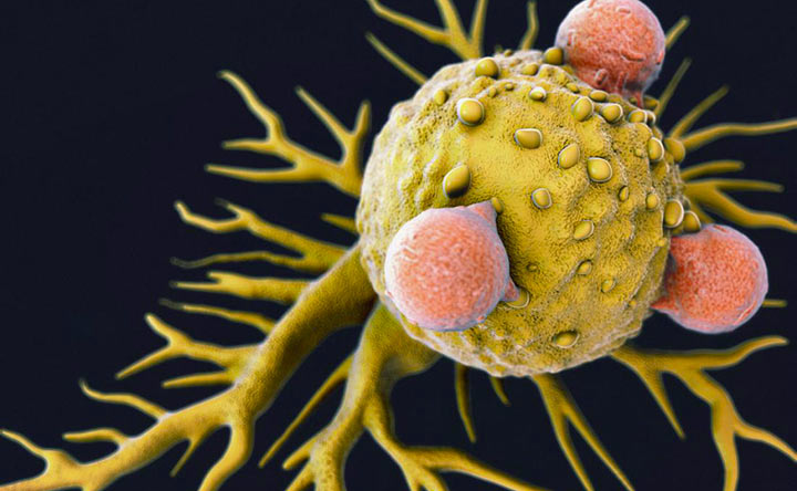 Un particolare virus può indurre risposte immunitarie contro il cancro?
