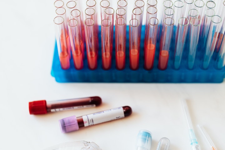 Biopsia liquida: da una goccia di sangue grandi speranze per la diagnosi precoce dei tumori
