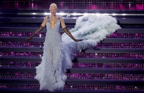 La modella Bianca Balti e il suo Sanremo, simboli positivi della lotta al cancro