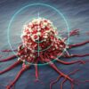Cancro, scoperti sia l’interruttore che facilita l’eliminazione delle metastasi che l’effetto della creatina sulla crescita dei tumori