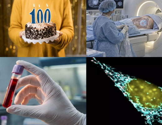 Novità dal mondo della ricerca e della clinica oncologica: ultracentenari, crioablazione con RMN, biopsia liquida e immunoterapia
